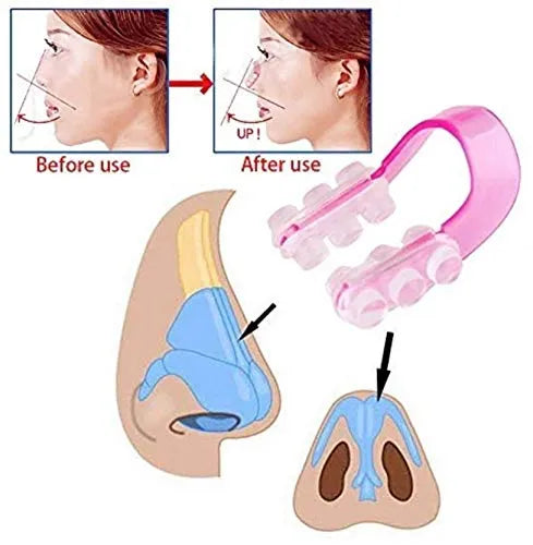 Silicone Nose Shaper